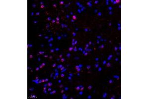 Immunofluorescence of paraffin embedded mouse spinal cord using ptgds (ABIN7075207) at dilution of 1:1700 (400x lens)