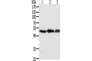 Western Blotting (WB) image for anti-Coagulation Factor VII (F7) antibody (ABIN2428811) (Factor VII anticorps)
