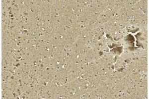 Immunohistochemical analysis of paraffin-embedded Human brain section using Pink1 D.