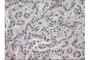 Image no. 2 for anti-Budding Uninhibited By Benzimidazoles 1 Homolog beta (Yeast) (BUB1B) antibody (ABIN1497000) (BUB1B anticorps)