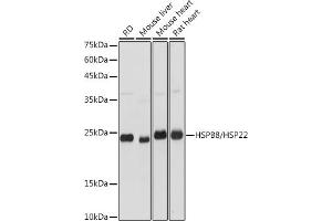 Western blot analysis of extracts of various cell lines, using HSPB8/HSP22 antibody (ABIN3016166, ABIN3016167, ABIN3016168 and ABIN6219596) at 1:3000 dilution. (HSPB8 anticorps  (AA 1-196))