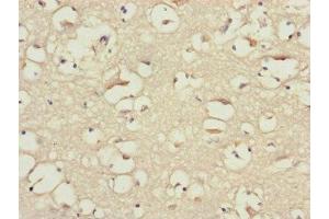 Immunohistochemistry of paraffin-embedded human brain tissue using ABIN7145604 at dilution of 1:100 (BLOC1S2 anticorps  (AA 44-142))