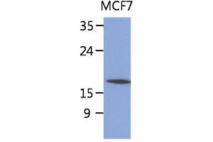 The lysate of MCF7 (40ug) were resolved by SDS-PAGE, transferred to PVDF membrane and probed with anti-human SSR4 antibody (1:1000). (SSR4 anticorps)