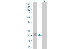 Western Blot analysis of MBD5 expression in transfected 293T cell line by MBD5 MaxPab polyclonal antibody.