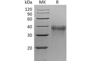 Western Blotting (WB) image for Triggering Receptor Expressed On Myeloid Cells 1 (TREM1) protein (His tag) (ABIN7320673)