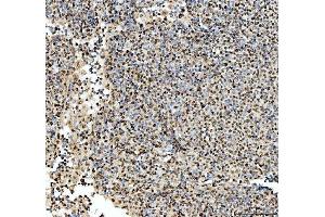 IHC analysis of SFPQ using anti-SFPQ antibody (ABIN7603089). (SFPQ anticorps  (Middle Region))