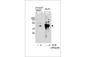 Western blot analysis of extracts from A431 cell,untreated or treated with EGF,100 ng/mL,using Phospho-MEK1-p(left) or MEK1-p Antibody (right). (MEK1 anticorps  (pSer222))