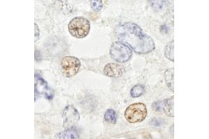 anti-DEAD (Asp-Glu-Ala-Asp) Box Polypeptide 46 (DDX46) (C-Term) antibody