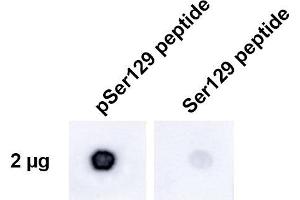 Dot Blot analysis using Rabbit Anti-Alpha Synuclein pSer129 Monoclonal Antibody, Clone J18 (ABIN6932864). (SNCA anticorps  (pSer129) (Atto 594))