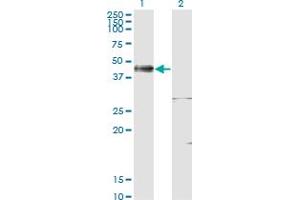 Western Blot analysis of ISL1 expression in transfected 293T cell line by ISL1 monoclonal antibody (M02), clone 4A7. (ISL1 anticorps  (AA 63-159))