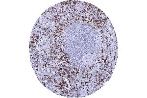 Spleen Numerous MPO positive granulocytes are usually seen within the red pulp of the spleen