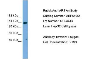 WB Suggested Anti-IARS  Antibody Titration: 0.