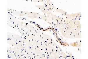 Immunohistochemistry analysis of paraffin-embedded rat heart using DLL4 Polyclonal Antibody at dilution of 1:200.
