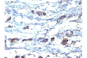 Formalin-fixed, paraffin-embedded human Stomach tissue stained with CD195 Mouse Monoclonal Antibody (12D1).