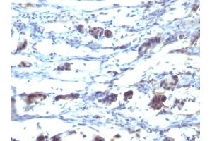 Formalin-fixed, paraffin-embedded human Stomach tissue stained with CD195 Mouse Monoclonal Antibody (12D1). (CCR5 anticorps)