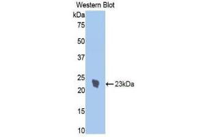 Western Blotting (WB) image for anti-Interleukin 1 Receptor, Type I (IL1R1) (AA 386-553) antibody (ABIN1859386) (IL1R1 anticorps  (AA 386-553))