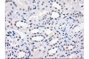 Image no. 10 for anti-Fc Fragment of IgG, Low Affinity IIa, Receptor (CD32) (FCGR2A) antibody (ABIN1497259)