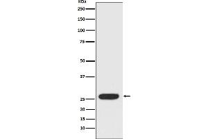 Western blot analysis of StAR expression in SK-BR-3 cell lysate.