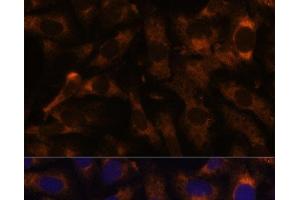 Immunofluorescence analysis of U-2 OS cells using SUCLG2 Polyclonal Antibody at dilution of 1:100 (40x lens).