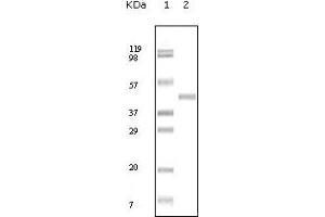 Western blot analysis using ABL2 mouse mAb against truncated ABL2 recombinant protein. (ABL2 anticorps)