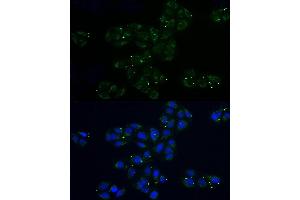 anti-Mitochondrial Ribosomal Protein L32 (MRPL32) (AA 19-188) antibody
