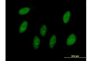 Immunofluorescence of purified MaxPab antibody to MAGOH on HeLa cell.