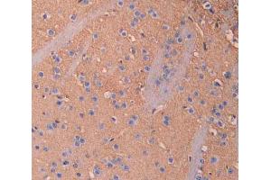Used in DAB staining on fromalin fixed paraffin- embedded brain tissue (IL18BP anticorps  (AA 29-193))