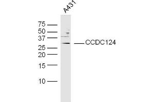 Human A431 cells probed with CCDC124 Polyclonal Antibody, unconjugated  at 1:300 overnight at 4°C followed by a conjugated secondary antibody at 1:10000 for 90 minutes at 37°C. (CCDC124 anticorps  (AA 145-223))