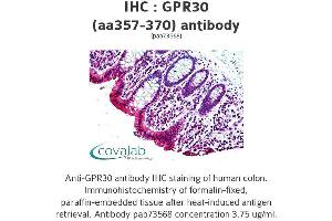 Image no. 1 for anti-G Protein-Coupled Estrogen Receptor 1 (GPER) (AA 357-370) antibody (ABIN1735055) (GPER anticorps  (AA 357-370))