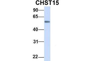Host:  Rabbit  Target Name:  CHST15  Sample Type:  Human Fetal Heart  Antibody Dilution:  1.