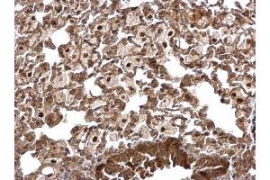 IHC-P Image PPP1CB antibody detects PPP1CB protein at nucleus and cytosol on mouse lung by immunohistochemical analysis.