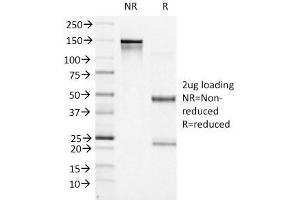 SDS-PAGE Analysis Purified BCL-6 Mouse Monoclonal Antibody (BCL6/1527).