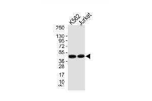Western blot analysis of extracts from, K562 cells (Lane 1) and Jurket cells (Lane 2), using Mnk1 (Ab-385) Antibody. (MKNK1 anticorps)