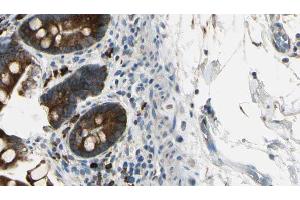 ABIN6267449 at 1/100 staining Mouse intestine tissue by IHC-P. (CXCR2 anticorps  (pSer347))