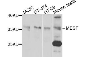 Western blot analysis of extracts of various cell lines, using MEST antibody. (MEST anticorps)