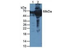 Figure. (F12 anticorps  (AA 400-615))