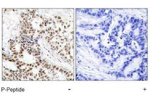 Image no. 1 for anti-Breast Cancer 1 (BRCA1) (pSer1423) antibody (ABIN196994) (BRCA1 anticorps  (pSer1423))