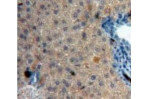 Used in DAB staining on fromalin fixed paraffin-embedded Liver tissue (IGFBP4 anticorps  (AA 22-254))