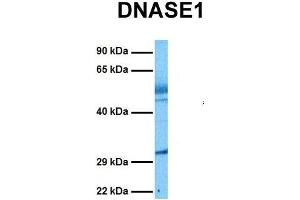 Host:  Rabbit  Target Name:  DNASE1  Sample Tissue:  Human Lung Tumor  Antibody Dilution:  1. (DNASE1 anticorps  (N-Term))
