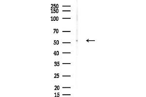 Western blot analysis of lysates from COLO205 cells, using CYP26 Antibody at 1/1000 dilution.
