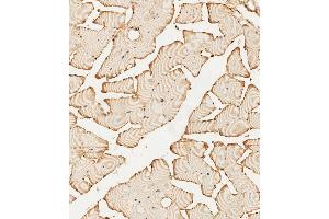 (ABIN392786 and ABIN2842224) staining PFKFB4 in human skeletal muscle tissue sections by Immunohistochemistry (IHC-P - paraformaldehyde-fixed, paraffin-embedded sections).