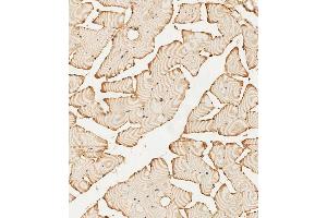 (ABIN392786 and ABIN2842224) staining PFKFB4 in human skeletal muscle tissue sections by Immunohistochemistry (IHC-P - paraformaldehyde-fixed, paraffin-embedded sections). (PFKFB4 anticorps  (AA 266-296))
