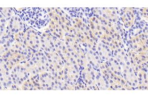 anti-Transforming Growth Factor, beta 3 (TGFB3) (AA 298-409) antibody