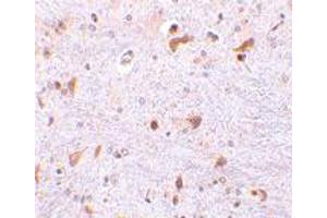 Immunohistochemistry of PDCD4 in mouse brain tissue with PDCD4 polyclonal antibody  at 2. (PDCD4 anticorps  (C-Term))