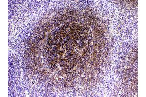 IHC analysis of CTLA4 using anti-CTLA4 antibody .