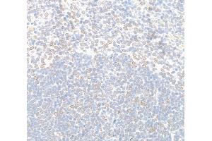 Immunohistochemistry (IHC) image for anti-Nucleoprotein TPR (TPR) (C-Term) antibody (ABIN7448922) (TPR anticorps  (C-Term))