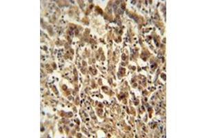 anti-Exosome Complex Exonuclease RRP44 (DIS3) (AA 302-331), (Middle Region) antibody