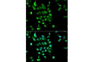 Immunofluorescence analysis of MCF7 cell using PSMC5 antibody.