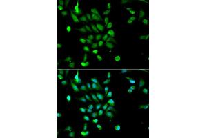 Immunofluorescence analysis of MCF7 cell using PSMC5 antibody. (PSMC5 anticorps  (AA 127-406))