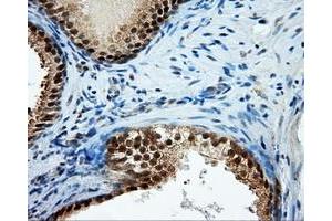 Immunohistochemical staining of paraffin-embedded Kidney tissue using anti-TPMT mouse monoclonal antibody.